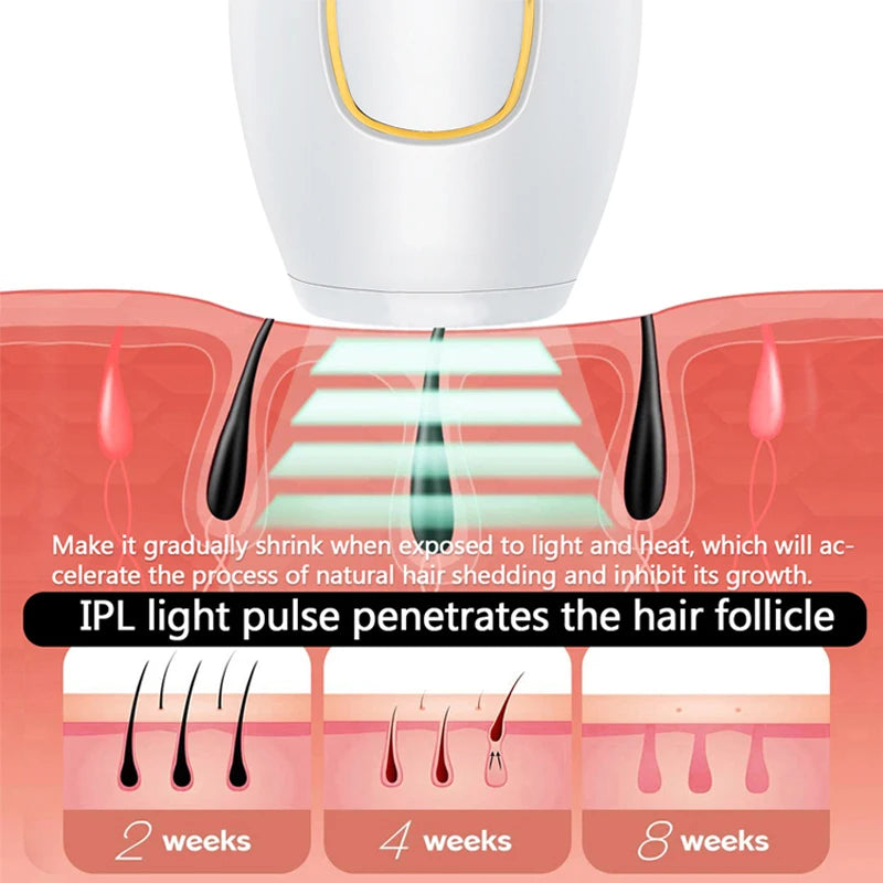 Depiladora Laser IPL Profesional